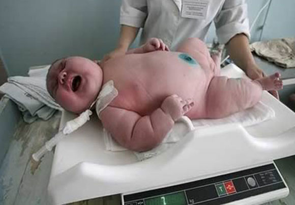 Младенцы-рекордсмены родившиеся с весом более 6 кг