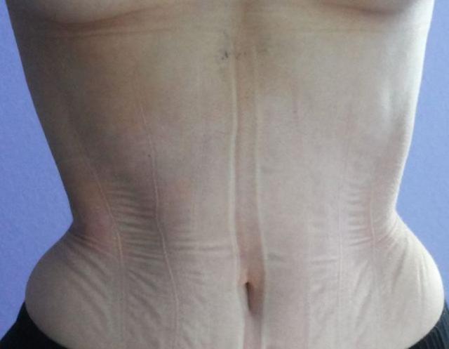 На что пошла девушка ради осиной талии Мишель Кобке, корсет 3 года, осиная тонкая талия 40 см