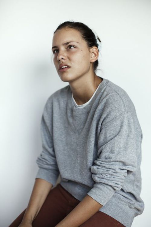 Моффи Модело - модель с косоглазием