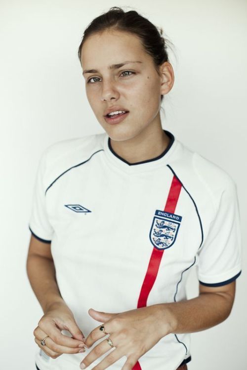 Моффи Модело - модель с косоглазием