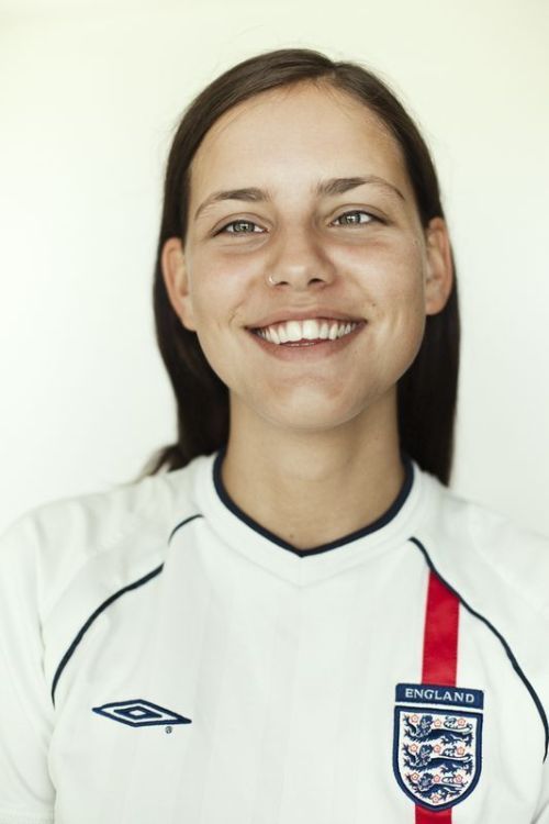 Моффи Модело - модель с косоглазием