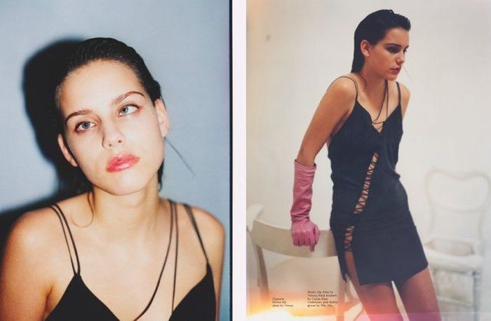 Моффи Модело - модель с косоглазием