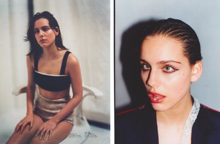 Моффи Модело - модель с косоглазием