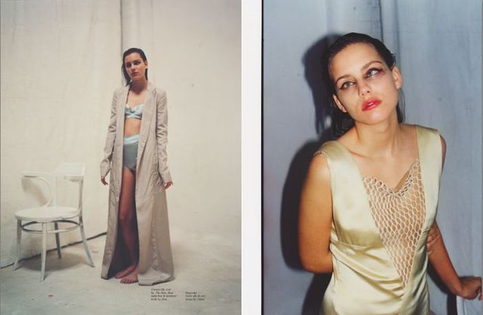 Моффи Модело - модель с косоглазием