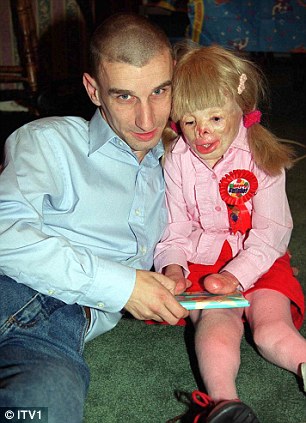 Девочка, без лица, пожар, Терри Кальвсберт, Terri Calvesbert, лицо, руки