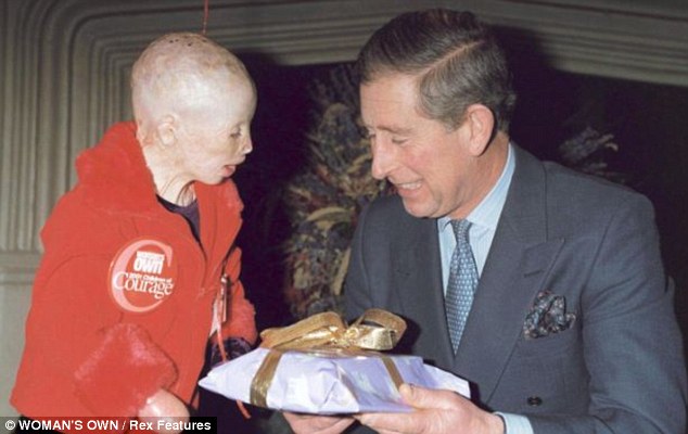 Девочка, без лица, пожар, Терри Кальвсберт, Terri Calvesbert, лицо, руки