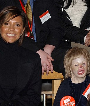 Девочка, без лица, пожар, Терри Кальвсберт, Terri Calvesbert, лицо, руки