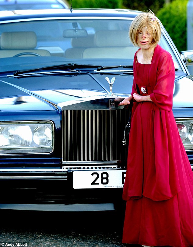 Девочка, без лица, пожар, Терри Кальвсберт, Terri Calvesbert, лицо, руки