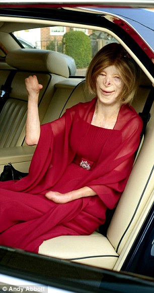 Девочка, без лица, пожар, Терри Кальвсберт, Terri Calvesbert, лицо, руки