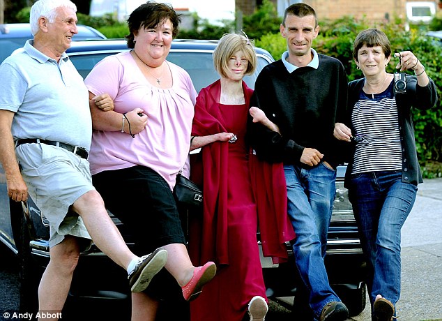 Девочка, без лица, пожар, Терри Кальвсберт, Terri Calvesbert, лицо, руки