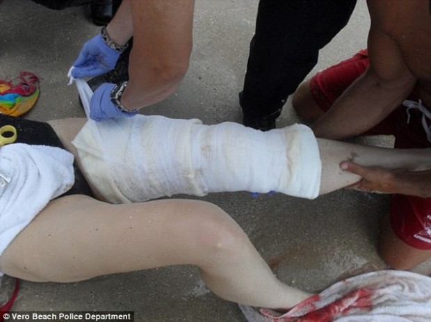 Что чувствуют люди, после, смертельных укусов, животных, смертоносных, черная вдова, бегемот, змея