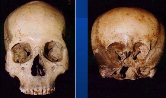 Перевал, Дятлова, загадки человечества, истории, объяснения