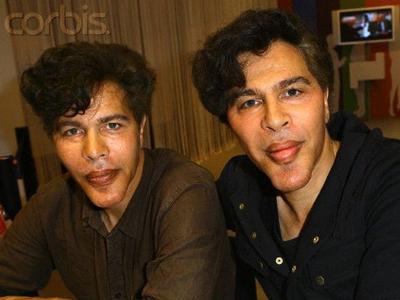 Жертвы, пластические операции, Голливуд, Богдановы, Сталлоне, Версаче, Риверз