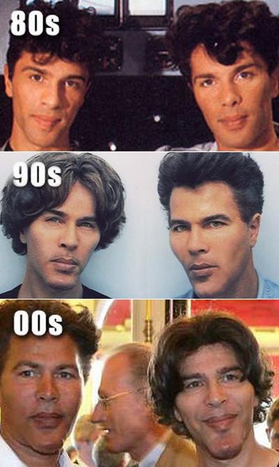 Жертвы, пластические операции, Голливуд, Богдановы, Сталлоне, Версаче, Риверз