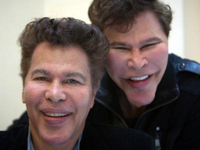 Жертвы, пластические операции, Голливуд, Богдановы, Сталлоне, Версаче, Риверз