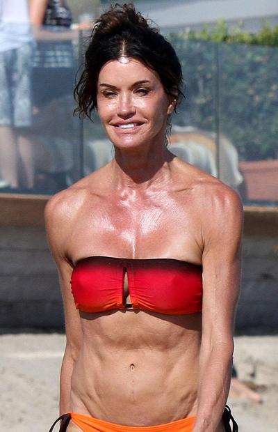 Жертвы, пластические операции, Голливуд, Богдановы, Сталлоне, Версаче, Риверз