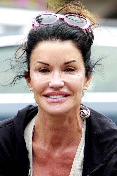 Жертвы, пластические операции, Голливуд, Богдановы, Сталлоне, Версаче, Риверз