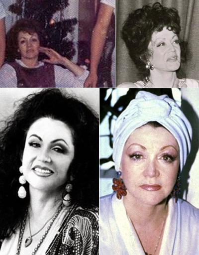 Жертвы, пластические операции, Голливуд, Богдановы, Сталлоне, Версаче, Риверз