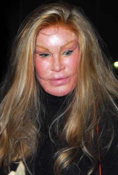 Жертвы, пластические операции, Голливуд, Богдановы, Сталлоне, Версаче, Риверз