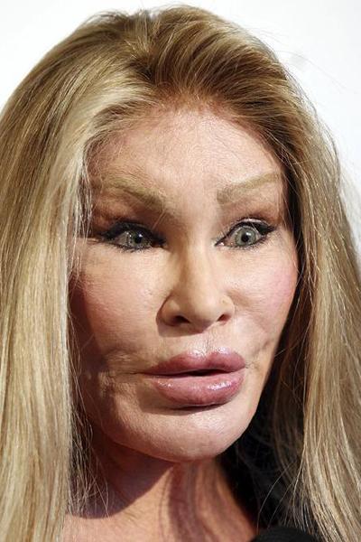 Жертвы, пластические операции, Голливуд, Богдановы, Сталлоне, Версаче, Риверз