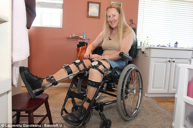 Хлоя Дженнингс-Уайт, Chloe Jennings-White, BIID, парализованной, расстройство личности