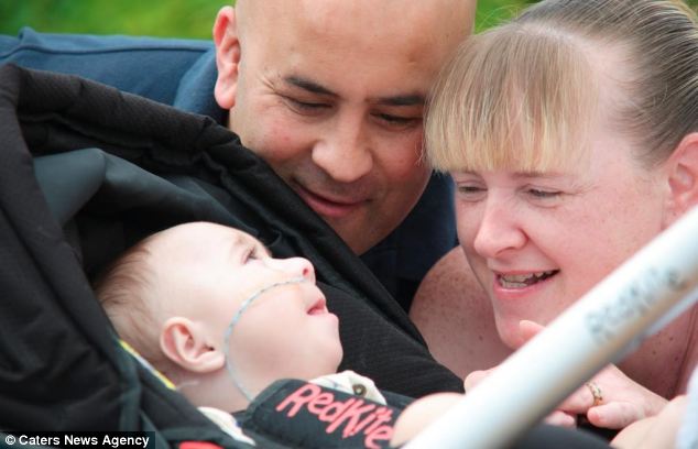 Синдром Патау, девочка Джесс, реанимируют 5 раз в день, поцелуй жизни, дыхание рот в рот