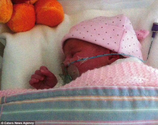 Синдром Патау, девочка Джесс, реанимируют 5 раз в день, поцелуй жизни, дыхание рот в рот