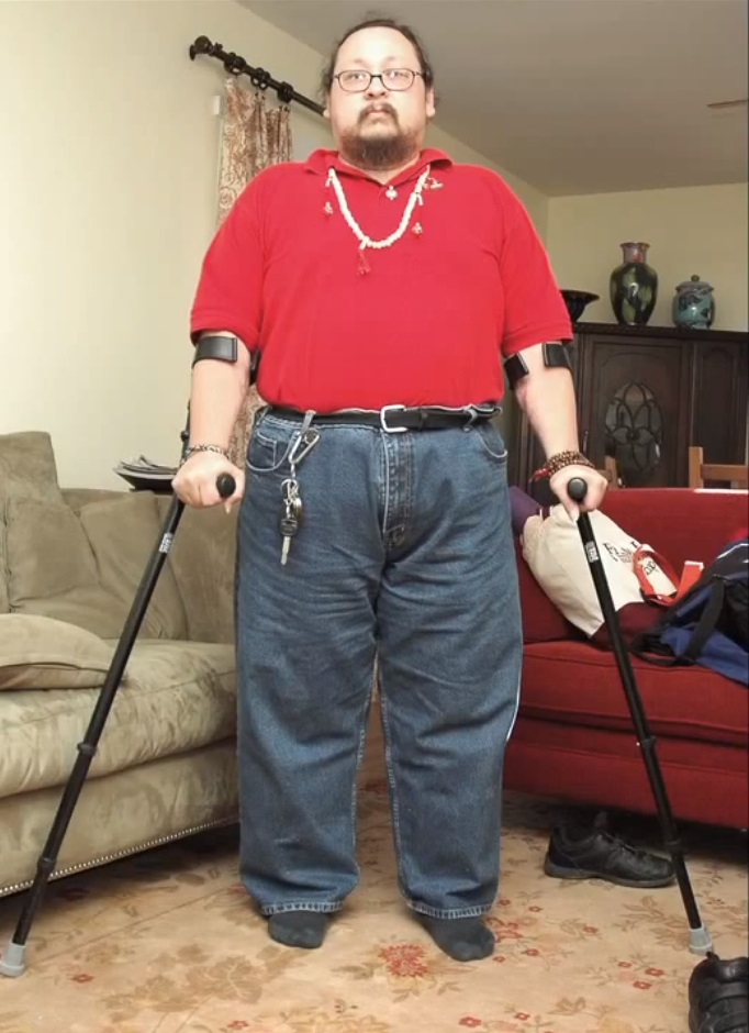 История инвалида, который смог встать на ноги