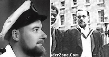 первые в мире пластические операции, люди перенесшие первые пластические операции, первые в истории пластические операции