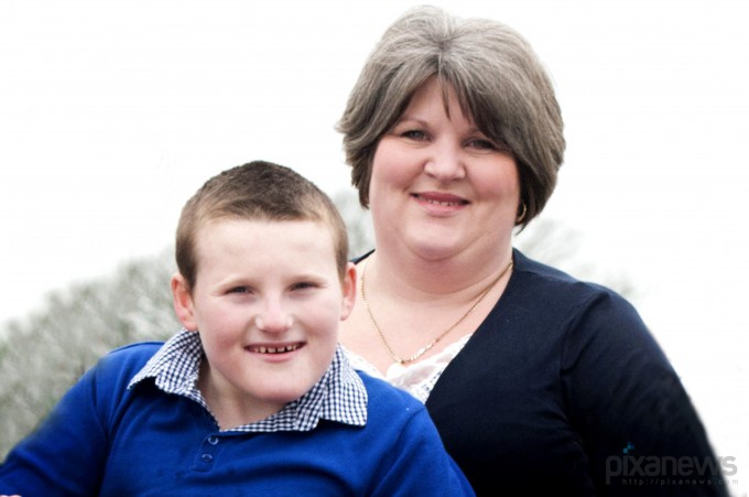 Мальчик с вечной улыбкой на лице Джеймс Эдгар,улыбка,синдром Ангельмана