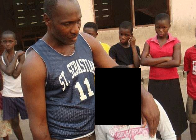 Гана,сиротка-инвалид,лицевое уродство, Гана, Tumblr,операция,болезнь