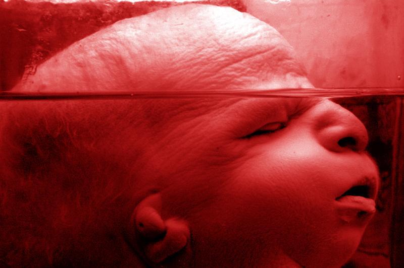 Анатомические музеи, человеческого тела, трупы, Кунсткамера в Санкт-Петербурге