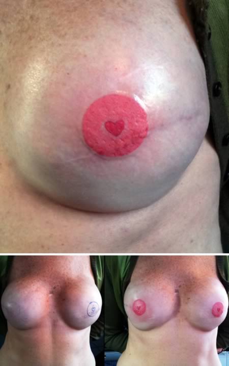 Татуировки, тату, на женской, груди, шрам, мастэктомия, женщины, рак, операции