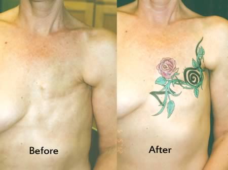 Татуировки, тату, на женской, груди, шрам, мастэктомия, женщины, рак, операции