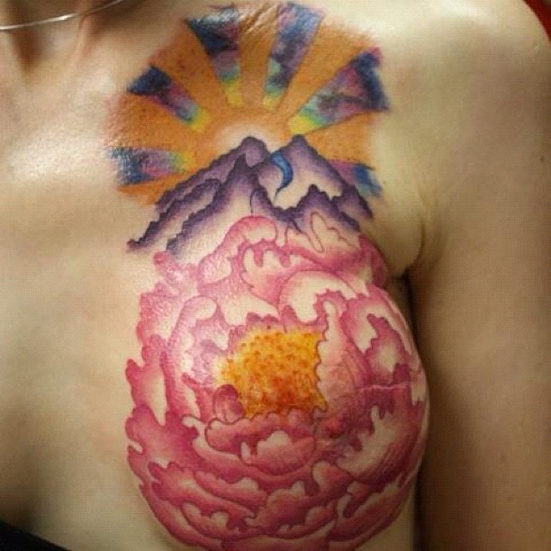 Татуировки, тату, на женской, груди, шрам, мастэктомия, женщины, рак, операции
