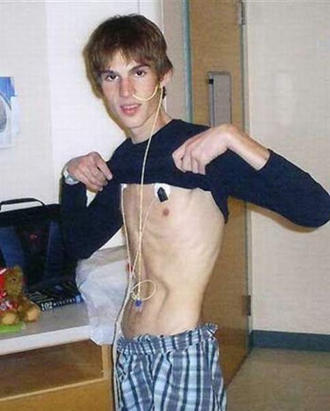 Студент по обмену вернулся домой анорексиком Джонатан Маккалум, по обмену, Египет, анорексия