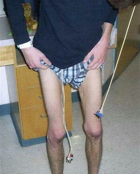 Студент по обмену вернулся домой анорексиком Джонатан Маккалум, по обмену, Египет, анорексия