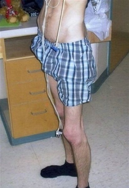 Студент по обмену вернулся домой анорексиком Джонатан Маккалум, по обмену, Египет, анорексия