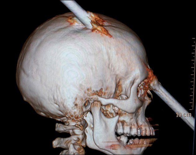 чудом избежали смерти, остались в живых 