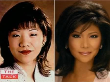 люди,жесть,шок,пластические операции