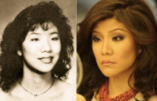 люди,жесть,шок,пластические операции