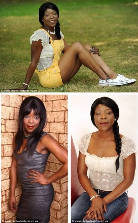 люди,жесть,шок,пластические операции