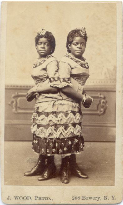 Ретро фотографии людей из шоу уродов шоу уродов, фрики, викторианская эпоха, Чарльз Эйзенманн charles eisenmann