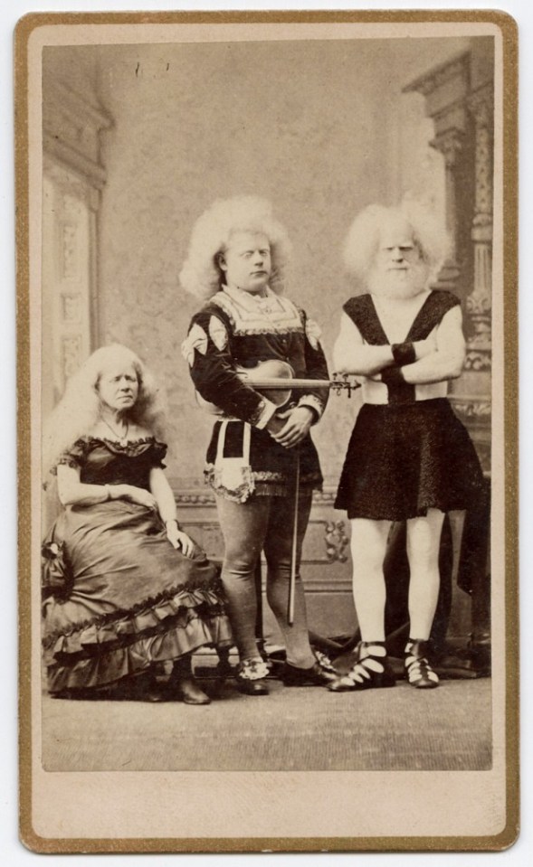 Ретро фотографии людей из шоу уродов шоу уродов, фрики, викторианская эпоха, Чарльз Эйзенманн charles eisenmann