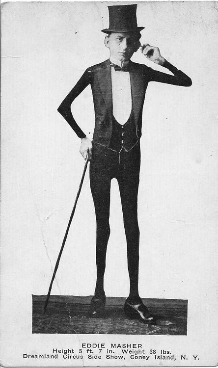 Ретро фотографии людей из шоу уродов шоу уродов, фрики, викторианская эпоха, Чарльз Эйзенманн charles eisenmann