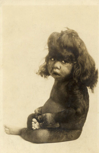 Ретро фотографии людей из шоу уродов шоу уродов, фрики, викторианская эпоха, Чарльз Эйзенманн charles eisenmann