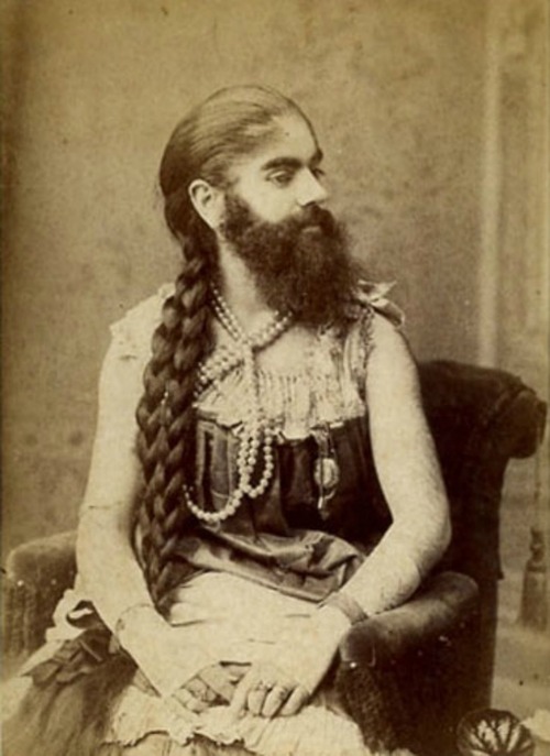 Ретро фотографии людей из шоу уродов шоу уродов, фрики, викторианская эпоха, Чарльз Эйзенманн charles eisenmann