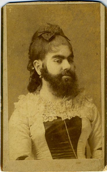 Ретро фотографии людей из шоу уродов шоу уродов, фрики, викторианская эпоха, Чарльз Эйзенманн charles eisenmann