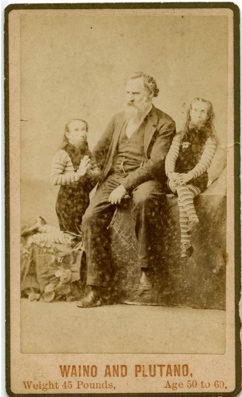 Ретро фотографии людей из шоу уродов шоу уродов, фрики, викторианская эпоха, Чарльз Эйзенманн charles eisenmann