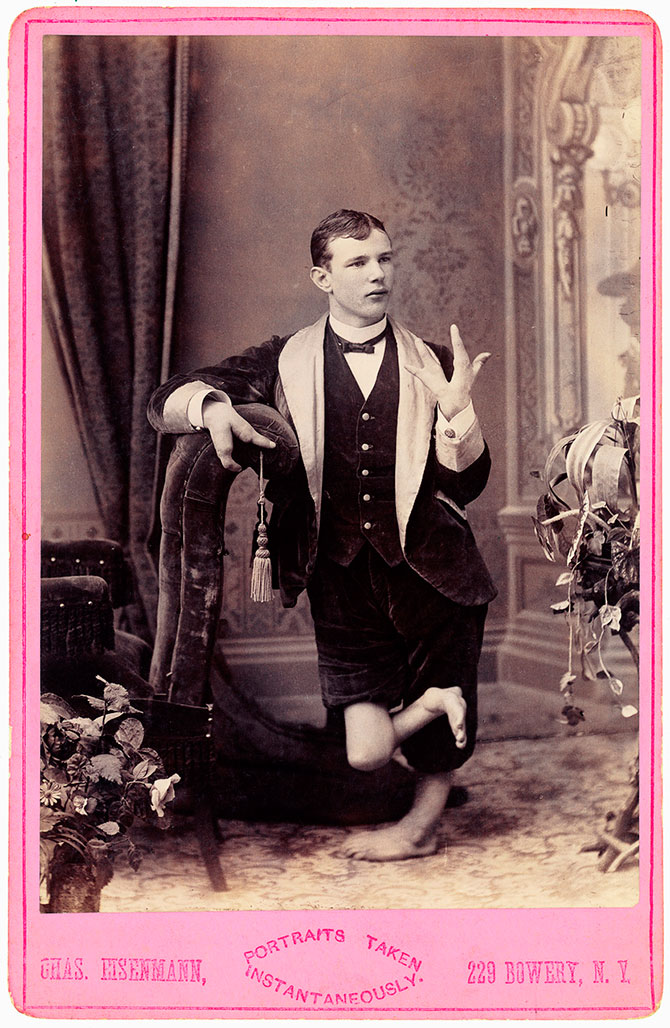 Ретро фотографии людей из шоу уродов шоу уродов, фрики, викторианская эпоха, Чарльз Эйзенманн charles eisenmann